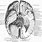 Base of Brain Anatomy