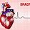 Bradycardia Image