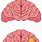 Brain Tumor Cartoon