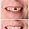 Broken Teeth Before and After