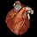 Cardiac CT Angiography