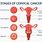 Cervix Cancer Images