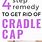 Cradle Cap Remedies