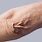 Crepey Arm Skin