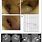 Ear Canal Stenosis