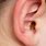 Ear Clogged Wax