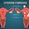 Enlarged Uterus and Fibroids