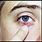 Eyelid Infection Symptoms
