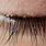Eyelid Lice