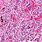 Granuloma Cells