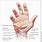 Hand Nerve Pain