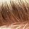 Head Lice Hair
