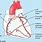 Heart Arteries Widowmaker