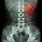 Kidney X-ray