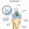 Knee ACL Reconstruction