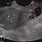 Nabothian Cyst On Ultrasound