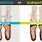 Pronation vs Supination Shoe Wear