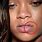 Rihanna Lip Scar
