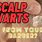 Scalp Wart Treatment
