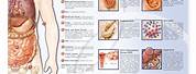 Sexually Transmitted Diseases Chart
