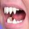 Sharpest Human Teeth