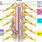 Spinal Cord Meningioma