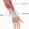 Tendonitis Wrist and Thumb