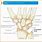 Ulnar-Sided Wrist Pain
