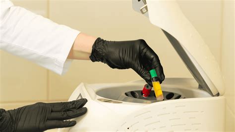 PRP Therapy Explained: How Platelet-Rich Plasma Helps Heal Joint and Tendon Injuries - San Diego ...