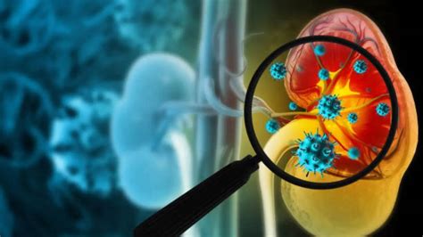 The First Sign of Kidney Failure is Not Back Pain; Here Are the Early ...