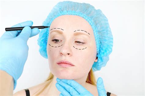 ¿Qué tan dolorosa es la cirugía de feminización facial? Una guía honesta para la recuperación.