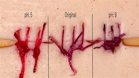 Meet Dasia Taylor: High school student who created surgical threads ...
