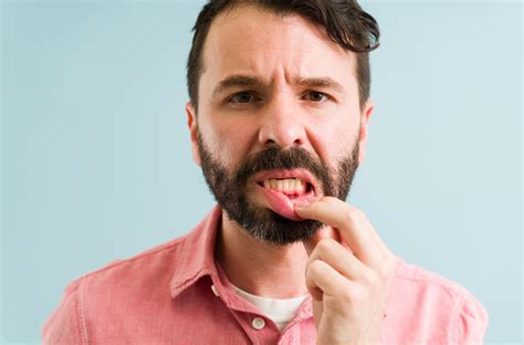 Gum Disease Stages: How Periodontal Disease Progresses