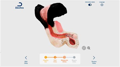 Modelos 3D anatómicos - Imascono | Te acompañamos al futuro