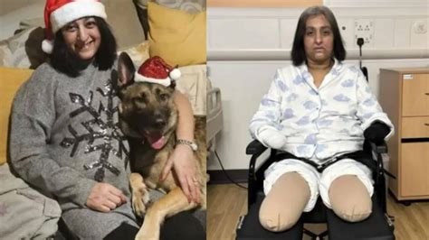 Woman loses 4 limbs after dog’s lick triggers sepsis: Warning signs of ...