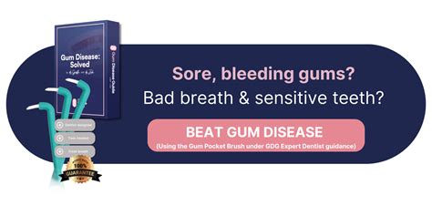 How to Stop Gum Recession Naturally ⋆ ctf.bnsf.com