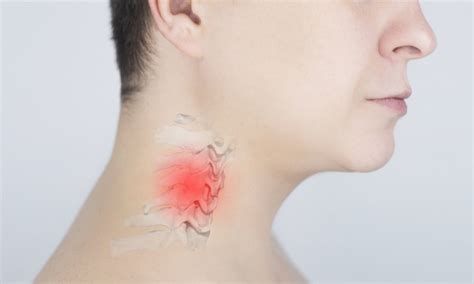 Cervicalgia e formicolio alle braccia: la storia di Massimiliano ...