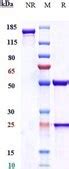 Anti-CEACAM5 / CEA / CD66e Reference Antibody | Sigma-Aldrich