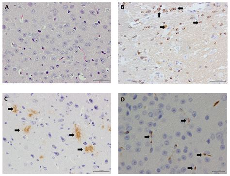Neuronal Count, Brain Injury, and Sustained Cognitive Function in 5×FAD ...