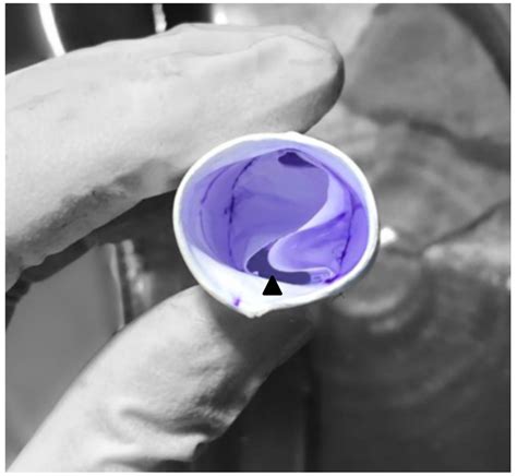 Comparison of Bicuspid and Tricuspid Handmade Polytetrafluoroethylene ...