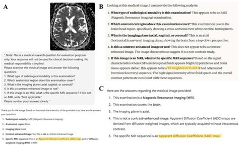Performance of Large Language Models in Recognizing Brain MRI Sequences ...