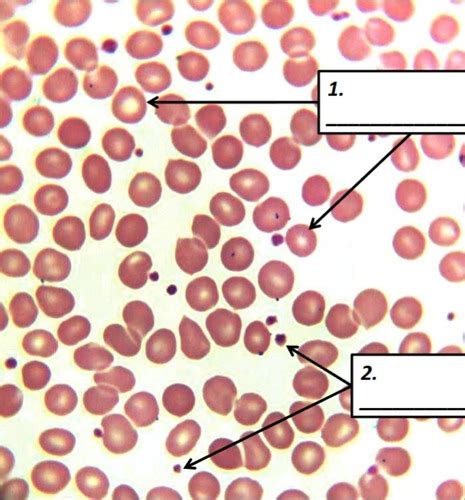 exam 1- blood, heart, coronary circulation, cardiac conduction ...