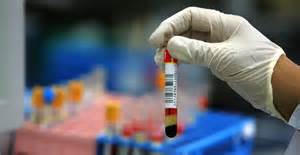 The devastating condition known as sepsis