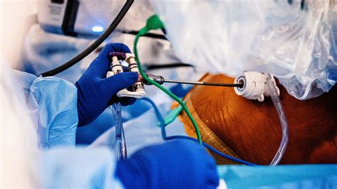 Bilateral Quadriceps Tendon Rupture — OrthopaedicPrinciples.com - Face Surgery