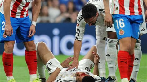 Mbappé’s stitches keep him out of Real’s training… Will he miss the ...