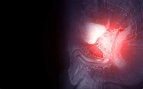 Prostate Cancer Risk Scores Explained: What AI Is Actually Measuring ...