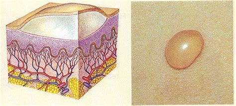 Skin and Nails Flashcards | Quizlet