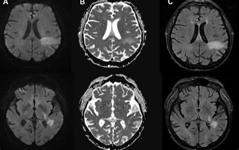 You're likely already infected with a brain-eating virus you've never ...