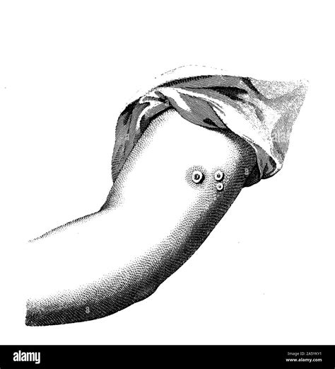 Immunity infectious Black and White Stock Photos & Images - Alamy