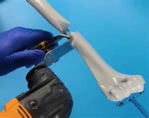 Surgical Secrets! How Popular Medical Procedures Are Performed